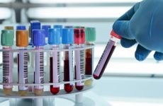 Blood Samples on Rack for Liquid Biopsy